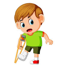 a broken leg